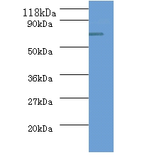 ureB Polyclonal Antibody