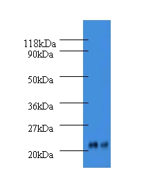 Alpha-1-acid glycoprotein 2 Polyclonal Antibody