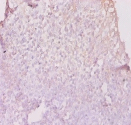 HLA class II histocompatibility antigen, DP beta 1 chain Polyclonal Antibody