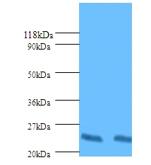 HLA class II histocompatibility antigen, DP beta 1 chain Polyclonal Antibody