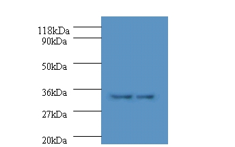 HLA class II histocompatibility antigen, DP alpha 1 chain Polyclonal Antibody