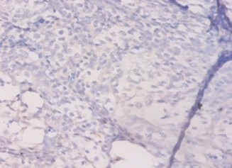 HLA class II histocompatibility antigen, DQ alpha 1 chain Polyclonal Antibody