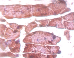 Titin Polyclonal Antibody