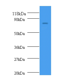 nrdD Polyclonal Antibody