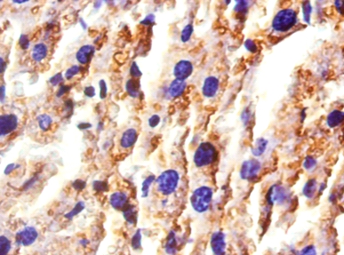 Haptoglobin Polyclonal Antibody