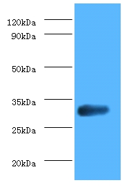 glsA1 Polyclonal Antibody