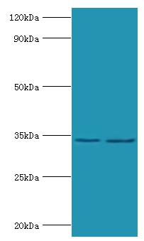 Phosphoprotein Polyclonal Antibody