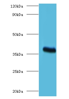 ptxA Polyclonal Antibody