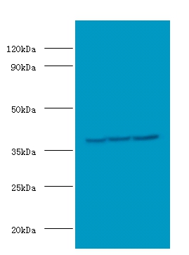 Casein kinase II subunit alpha' Polyclonal Antibody