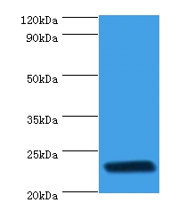 rpiA Polyclonal Antibody