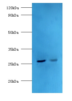 Adiponectin Polyclonal Antibody