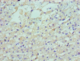 LDLRAP1 Polyclonal Antibody