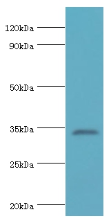 LDLRAP1 Polyclonal Antibody