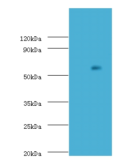 Uncharacterized aarF domain-containing protein kinase 2 Polyclonal Antibody