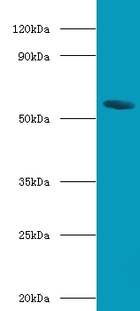 Bile acid receptor Polyclonal Antibody