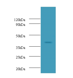 Ubiquitin-conjugating enzyme E2 Q2 Polyclonal Antibody