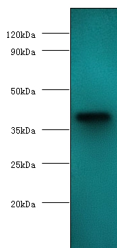 anemia virus apoptin Polyclonal Antibody