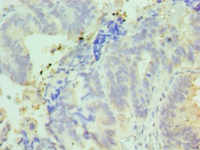 IFT57 Polyclonal Antibody