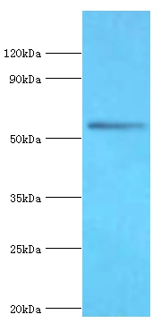 BRD9 Polyclonal Antibody