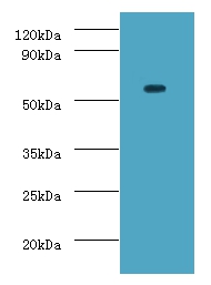 ATP-dependent RNA helicase DDX19A Polyclonal Antibody