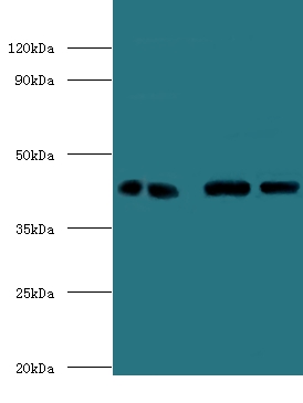 Endoplasmic reticulum-Golgi intermediate compartment protein 3 Polyclonal Antibody