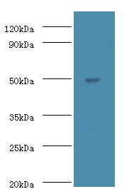 Actin-like protein 7A Polyclonal Antibody