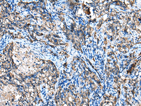 IGF2BP3 Antibody