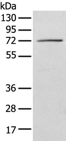 IGF2BP3 Antibody