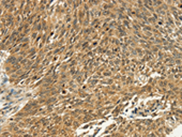 PSMD10 Antibody