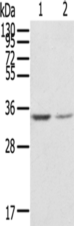 GNB2L1 Antibody