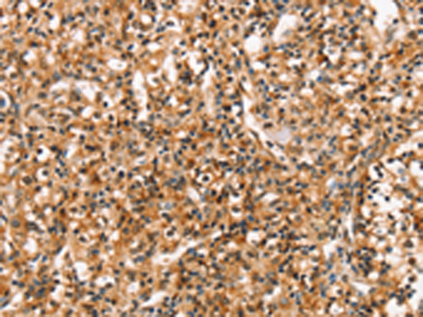 RGS1 Antibody