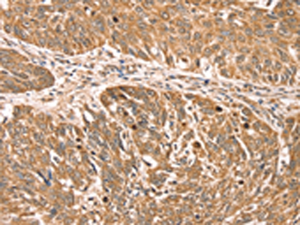 RPLP2 Antibody