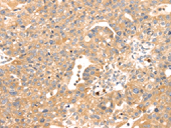 S100A12 Antibody