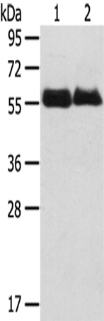 SRPX Antibody