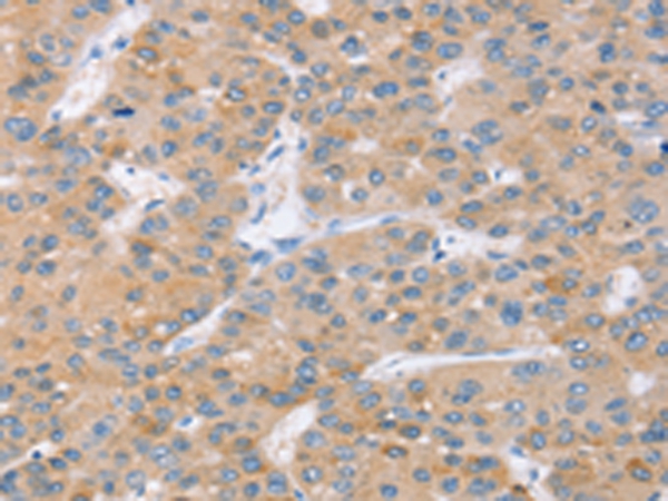 SLC27A2 Antibody