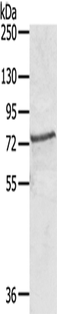 SKIL Antibody