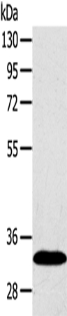 SULT2A1 Antibody