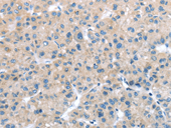 ITPA Antibody