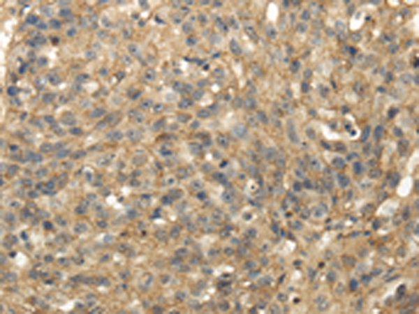 TACSTD2 Antibody