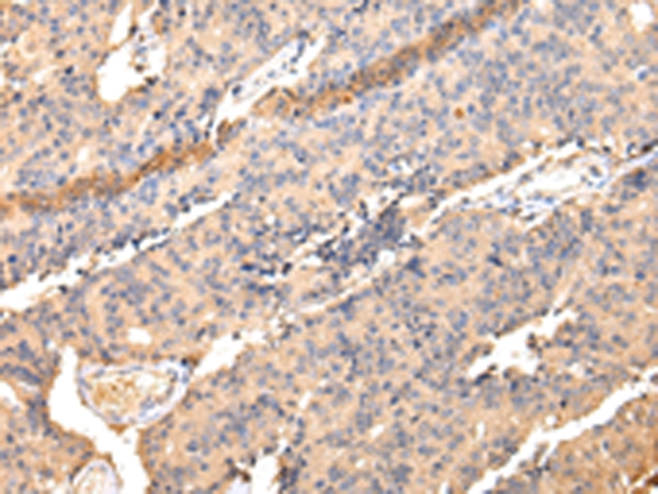 SDCBP Antibody