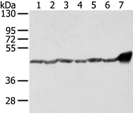 UQCRC1 Antibody