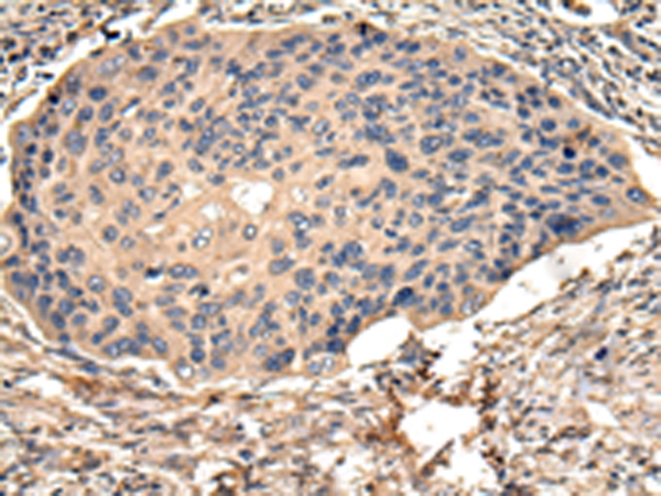 USP15 Antibody