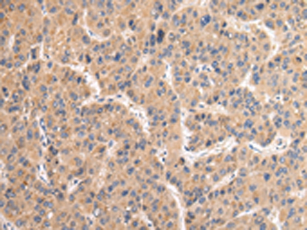 VAMP4 Antibody