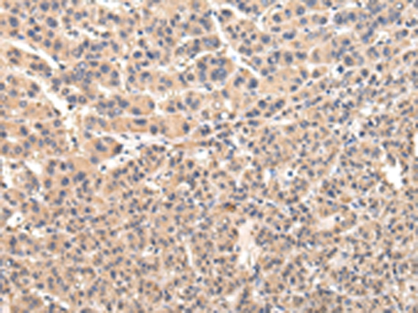 VPS45 Antibody