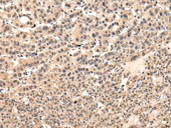 VPS37D Antibody