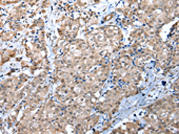 WDR4 Antibody