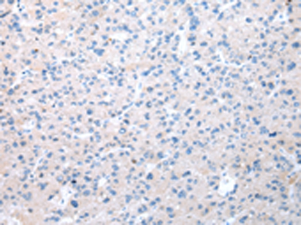 WDR19 Antibody