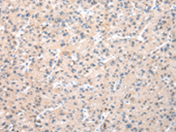 WDR77 Antibody