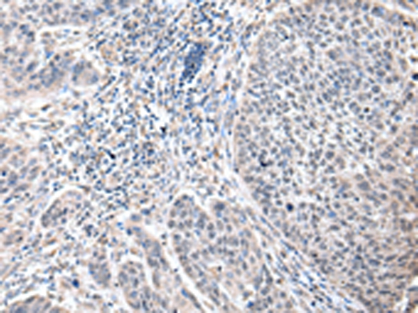 ZFP64 Antibody