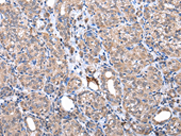 ZNF217 Antibody